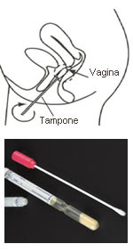 tampone-vaginale